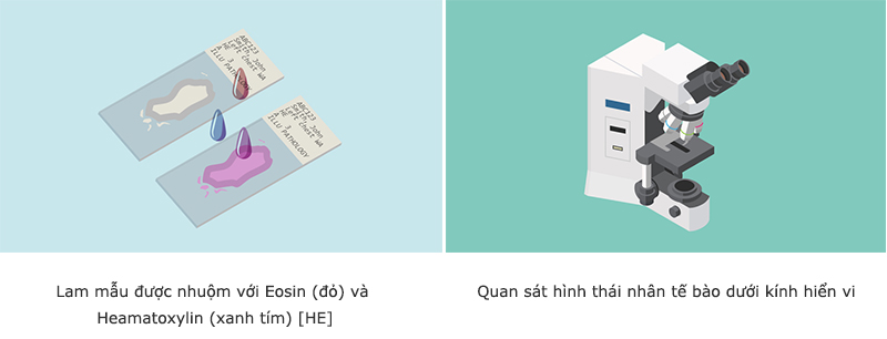 quy trinh giai phau benh 9