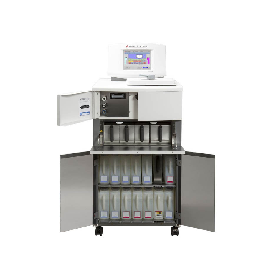 may xy ly mo khep kin