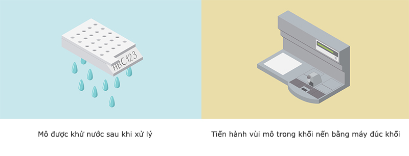 quy trinh giai phau benh 5