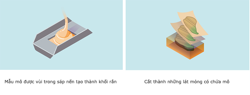 quy trinh giai phau benh 7